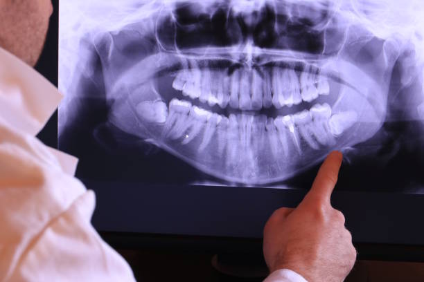 Best Emergency Dentist for Special Needs Patients in Coleytown, CT