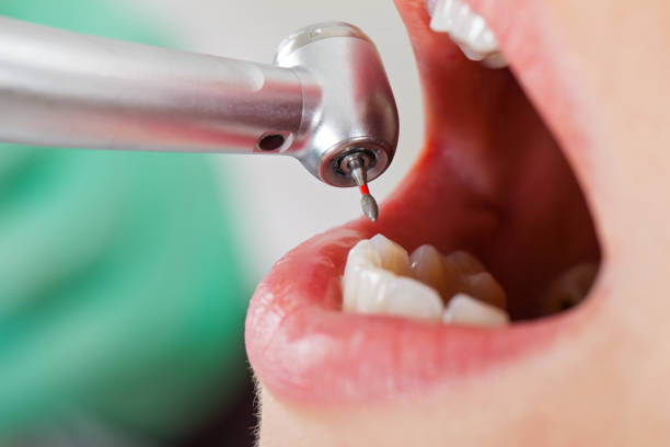 Best Urgent Dental Care for Toothache in Coleytown, CT